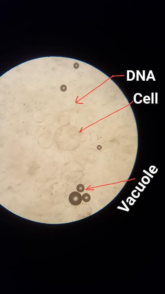 A cheek-cell smear under the microscope, with cell and vacuole labelled