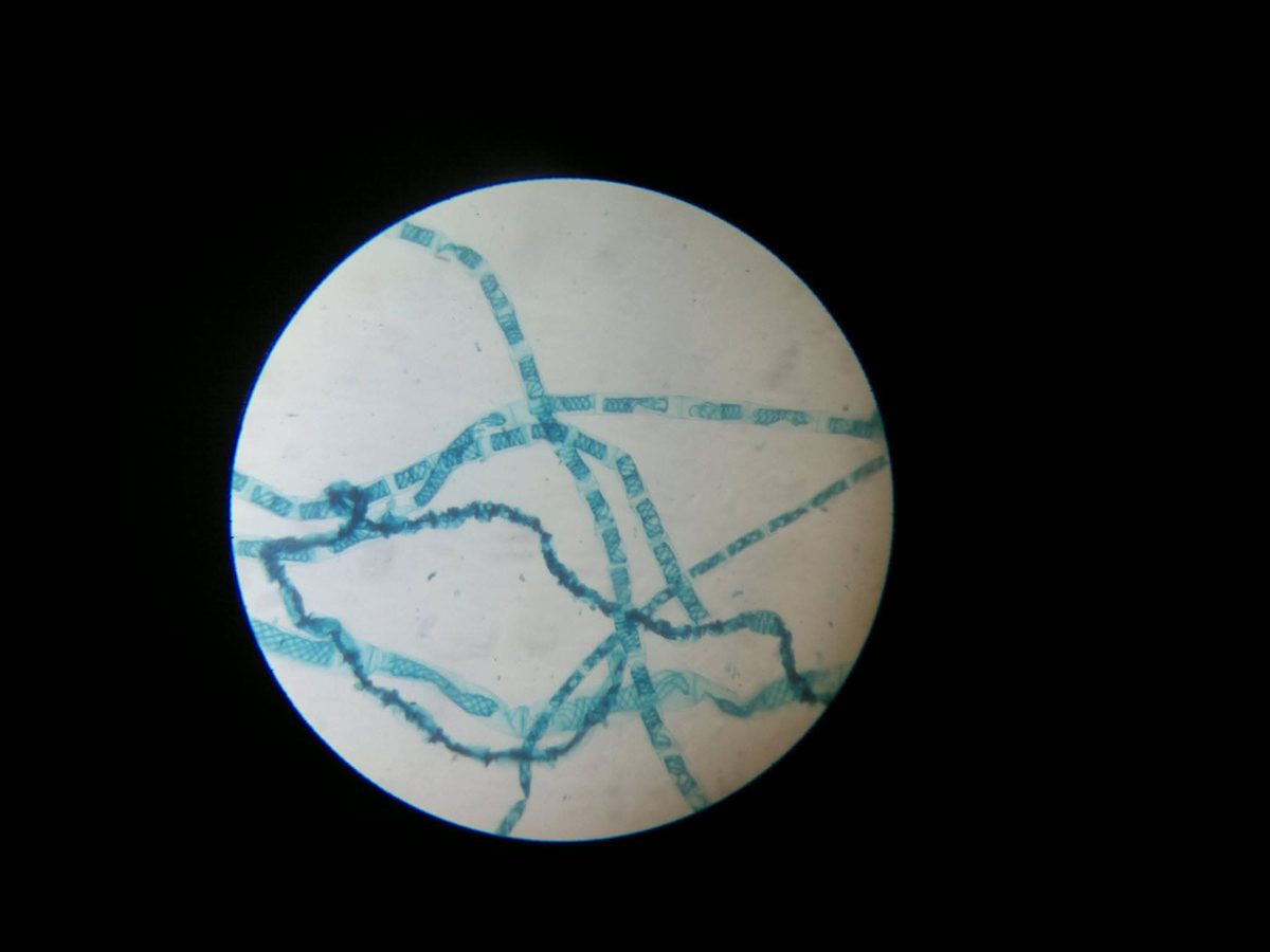 Spirogyra filaments under the microscope